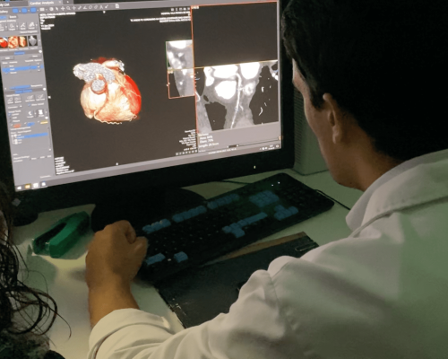 Trata-se de mais um passo na diferenciação de diagnóstico na patologia cardíaca 